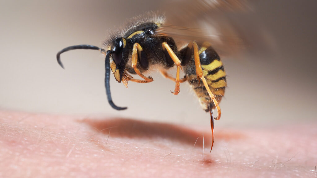 Yellow jacket stinging a human